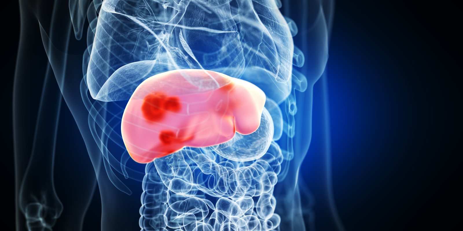 Alcohol's effects on your liver